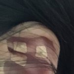 일주일마다 귀지앞<b>패치</b> 후기 남기러옴