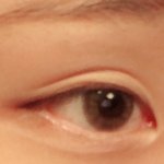 [ㅈㄱㄴ] <b>쌍거풀</b> 있다고 다 예쁜눈아님^^