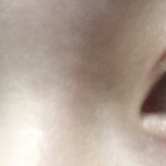 [댓글부탁해] +추가) <b>쌍수</b>하면 망할까? 봐줘ㅠㅠ