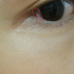 얘들아 나 눈 왜이래