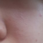 모공 ...개.. 스 ㅂ ㅓㄹ