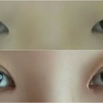 ㅋㅋㅋ나 쌍수 <b>전후</b> 개쩜