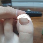 <b>발톱</b> 왜이러는지 아는사람?(<b>발톱</b>사진ㅇ