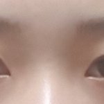 [조언부탁해] 코<b>필러</b>가나아 코수술이나아?