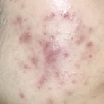 혐)<b>메디큐브</b> 컨실러 커버력 이정도면 ㅁㅌㅊ임??