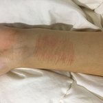 [댓글부탁해] 얘들아 이거 딱 봤을때 <b>자해</b>같아?