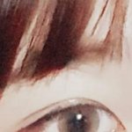 [댓글부탁해] 쌍수 재수술