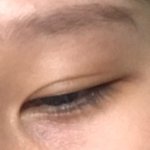 쌍수 9개월차 <b>티</b>가 너무 많이나