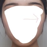 [조언부탁해] 나 얼굴비대칭됨;