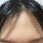 [드루와] <b>이마</b> 넓은거임?