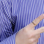 [인피니트] 우현이 손 상처