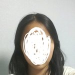 나 옆광대 <b>심해</b>??