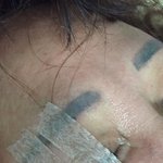 [개깊은빡<b>침</b>] 돈모아서 엄마 성형 시켜드렸는데 부작용.... 너무...