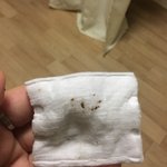 [조언부탁해] 고양이 귀에...