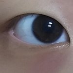 [댓글부탁해] 내 <b>눈</b> 현 상탠데 <b>눈</b> 지방 제거하면 커질거같음?