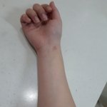 [19] 이거 키스<b>마크</b> 같아??