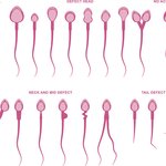 [워마드띵문] 여자들 출산력은 따지고 한국남자들의 <b>정자</b>력은 따지지마??