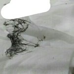 [19] 거기 <b>털</b> 제거 했음..+사진