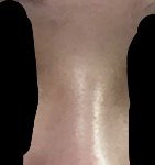 이런코는 성형하면 어떻게 해야함