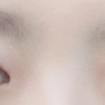 [꼭조언부탁] 눈평가 해주세요!) <b>매몰</b> 쌍수한지 5주정도 지났어요