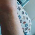 (약혐)<b>손목</b>에 이 두드러기 같은거모임ㅠㅠ