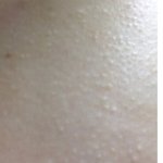 [댓글부탁해] 몸에 이거 왜생기는거야??????<b>닭살</b>이야??