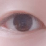 [사진ㅇ] <b>쌍수</b> 성공할까??