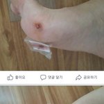 [개깊은빡침] 제천<b>입질</b>견물림사고 반박글올림!!!!!