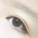 나 쌍수했는데 <b>아웃</b>라인으로 됐어ㅠㅠ