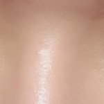 쌍수 절개 이 정도면