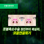 나 ㄹㅇ코끝연골 <b>풀림</b> ㅠㅜㅜㅜ
