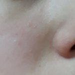 내 피부 왜이러냐ㅜㅜ