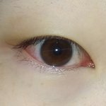 눈 갑자기 <b>충혈</b>됨 왜이래??