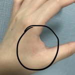 동그라미친곳이 <b>아파</b>ㅠㅠㅠㅠㅠ