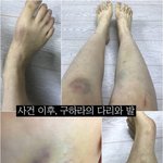 [드루와] 야 구하라 살려고 할퀸것 같은데;;