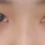 [조언부탁해] 진짜조카코성형하고싶다