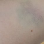 허위사실로 폭언과 폭행을 저지른 노인 고객 때문에 너무 <b>속상</b>합니다