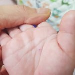 [개깊은빡침] <b>볼펜</b>잉크인지 가시인지 구분 못하고 손바닥 찢어놓은의사