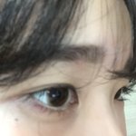 [댓글부탁해] 고데기하다 마빡 데엿는데 도와줘 ㅠㅠㅠㅠ