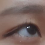 [댓글부탁해] <b>쌍수상담</b>