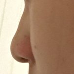[<b>댓글</b>부탁해] <b>저</b>처럼 이렇게 못생긴 코이신 분 있나요 ㅠㅠ?