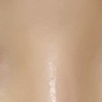 [댓글부탁해] <b>쌍수</b>한지1년된 후기