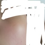 얘들아 나 <b>잡티</b> 많이 심해??