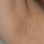 [19] 겨드랑이 제모 꿀팁