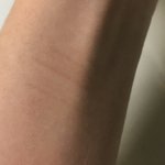 얘들아 나도 흉터 <b>티</b> 많이 <b>남</b>..?