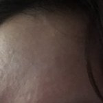 <b>피부결</b> 개선 조언좀 주라 ㅠ 제발(혐짤주의)
