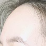 나 <b>이마</b> 튀어나온편이니 꺼진편이니