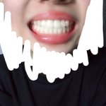 [댓글부탁해] 나<b>이빨</b> ㅈㄴ 가지런해