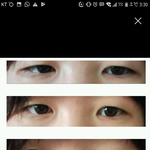 [드루와] 다들 쌍수하고 광명 찾아라
