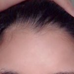 [댓글부탁해] 나 <b>이마라인</b>